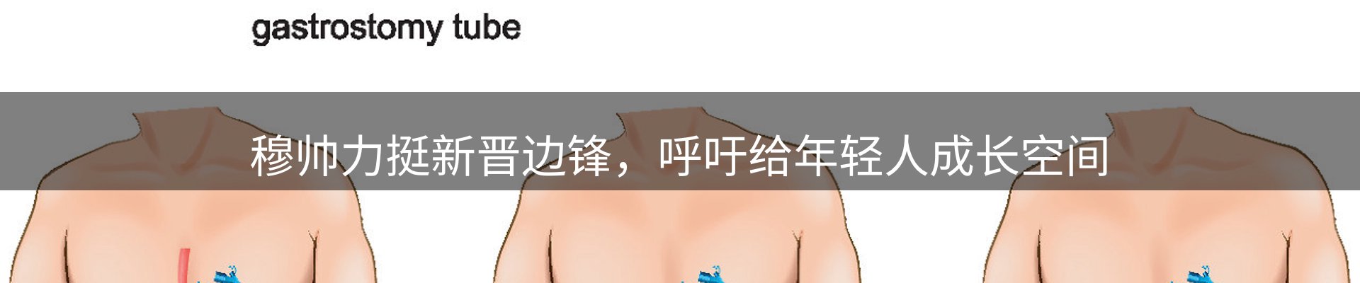 焦点展望
